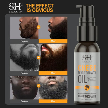 New 2023 Chebe Beard Growth Oil For Men Fast Effective Beard Growth Essential Hair Loss Treatment Product Sevich Beard Care 30ml