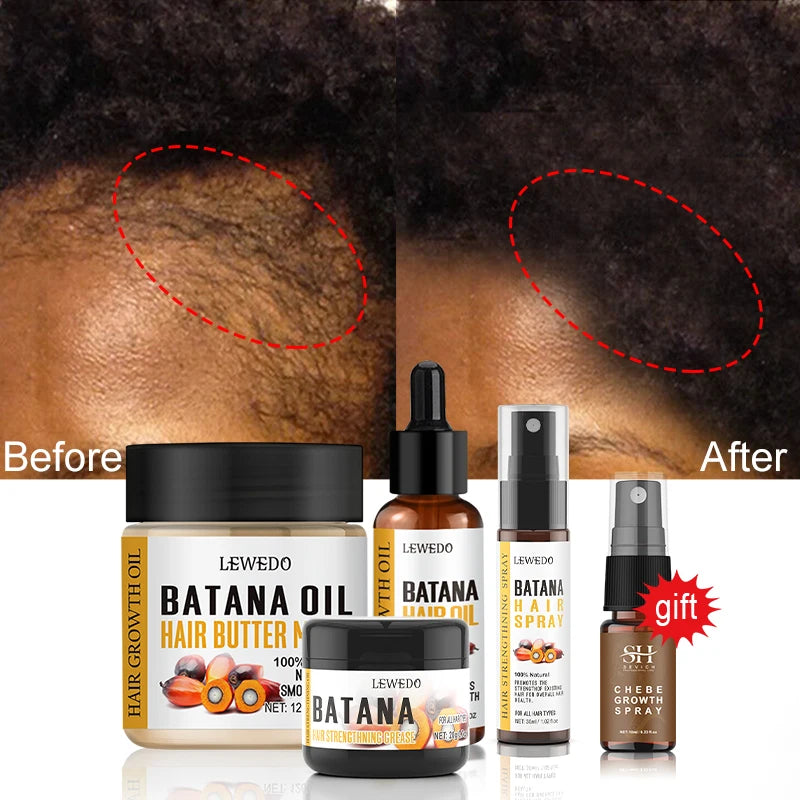 Fast Hair Growth Oil Africa Crazy Traction Alopecia batana Hair Mask Anti Hair Break Hair Strengthener Hair Loss Treatment Spray