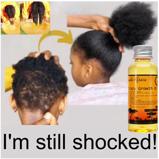 African Layden Oil Made by Ancient Methods GROW YOUR HAIR FASTER LONGER Visible Results Stop Breakage  Promotes Hair Growth