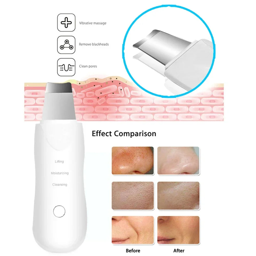 Professional No Ultrasonic Facial Skin Scrubber Ion Deep Face Cleaning Peeling Rechargeable Skin Care Device Beauty Instrument