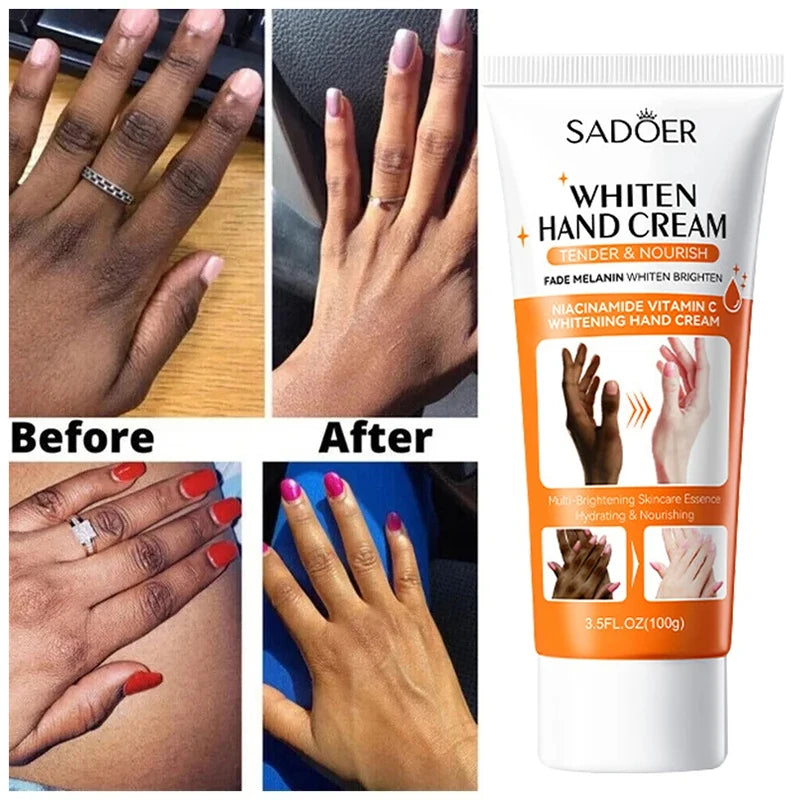 Articulation Fast Whitening Serum Anti Cracking Cream Pigmentation Correctors For Black Skin Intense Stains Remover Products